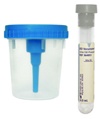 BD Vacutainer® Urine Collection Kits