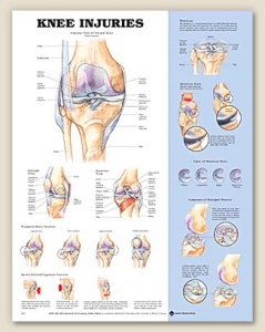 Knee Injuries Anatomical Chart 20" x 26" Laminated